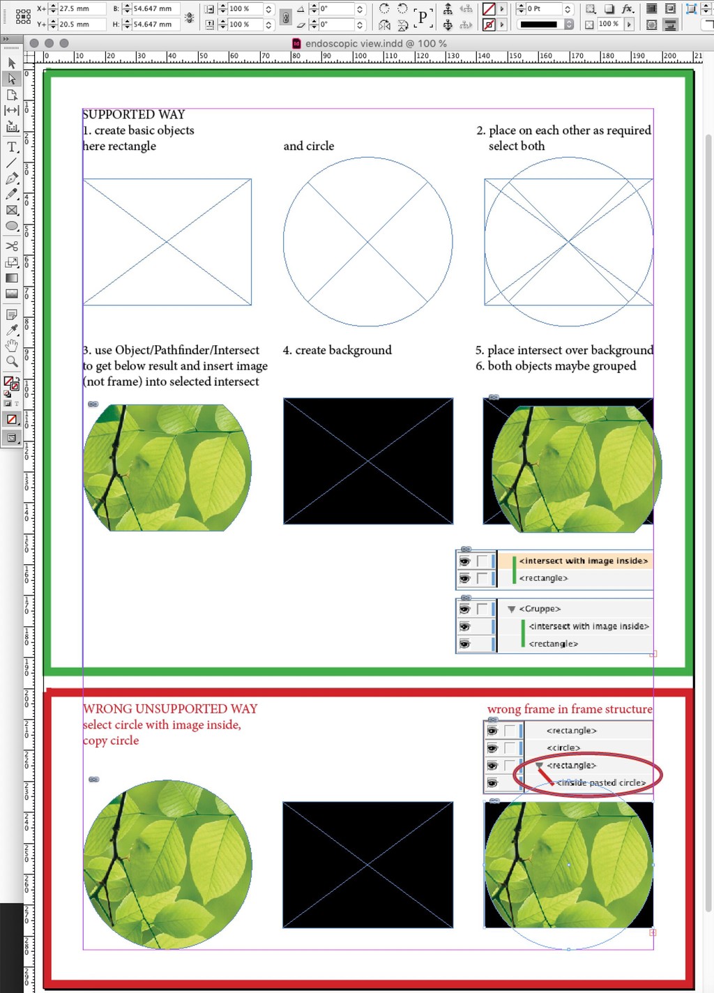 frame in frame on endoscopic view example.jpg